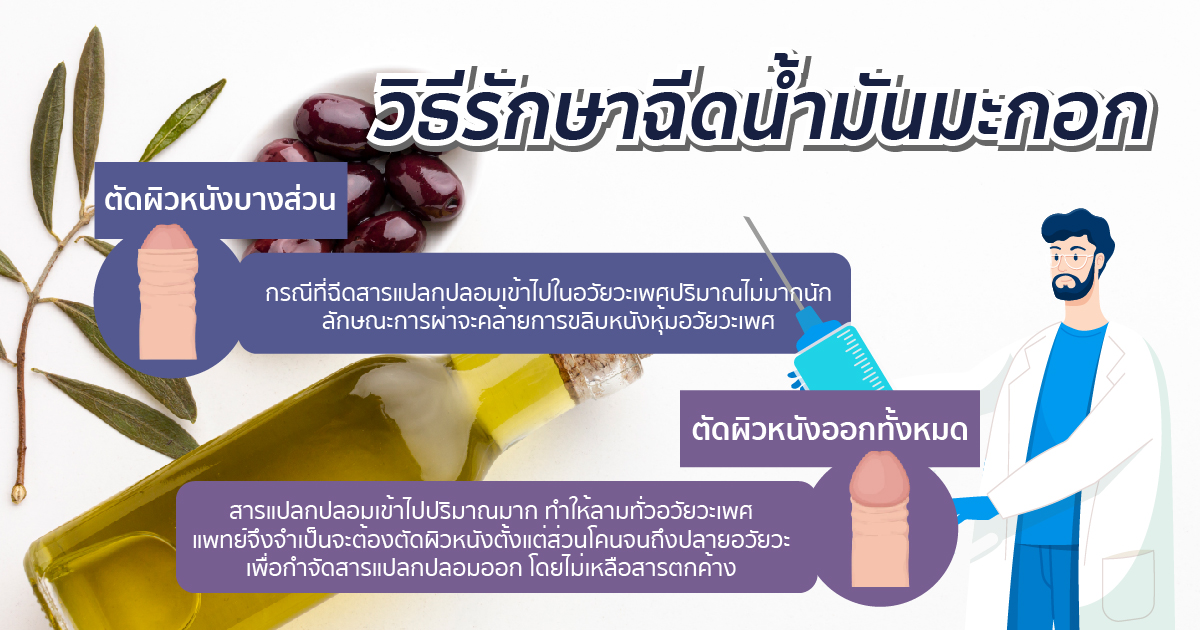 วิธีรักษาฉีดน้ำมันมะกอก ตัดผิดหนังบางส่วน ตัดผิดหนังออกทั้งหมด