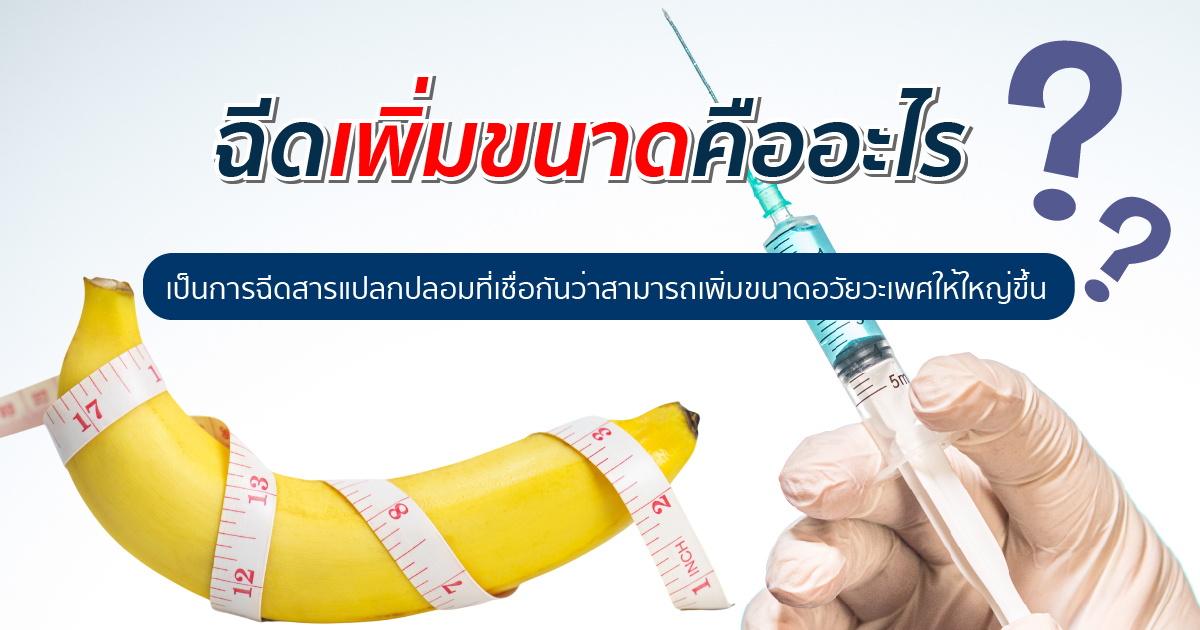 สารเพิ่มขนาด