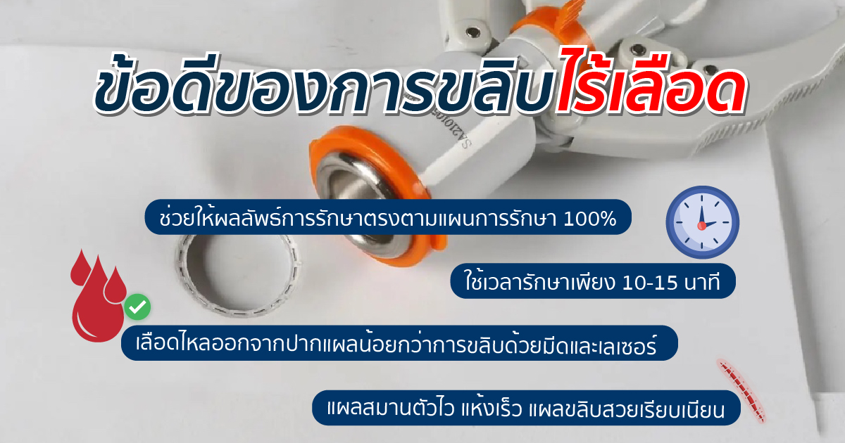 การขลิบไร้เลือด