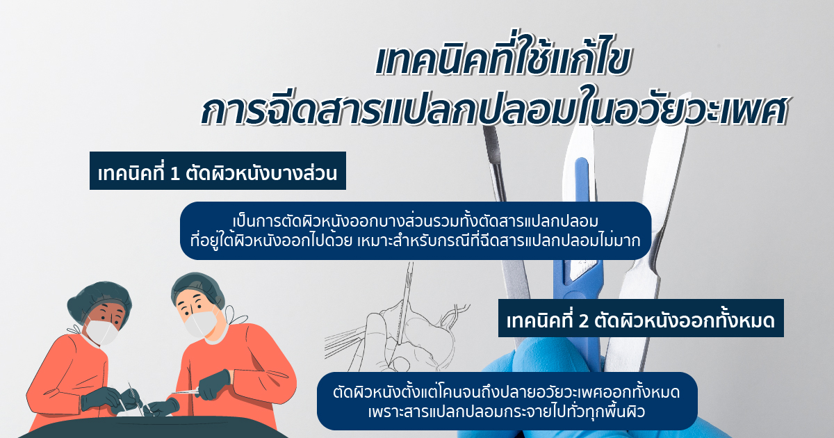 เทคนิคที่ใช้แก้ไขการฉีดสารแปลกปลอมในอวัยวะเพศ
