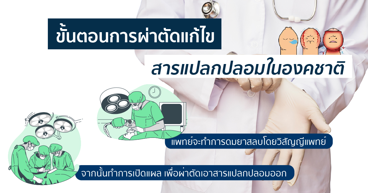 ขั้นตอนการผ่าตัด