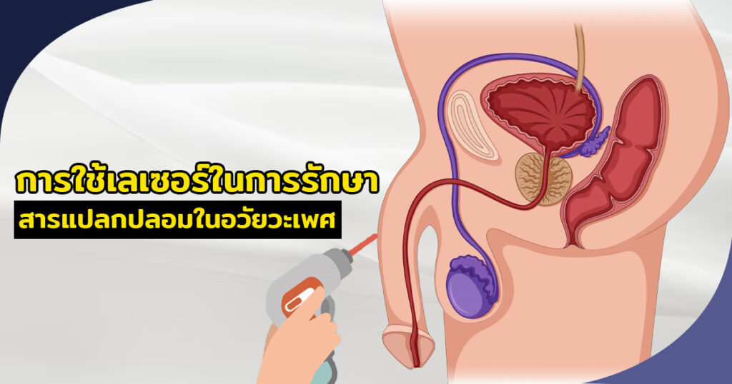 เเก้สารเเปลกปลอม