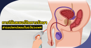 เเก้สารเเปลกปลอม