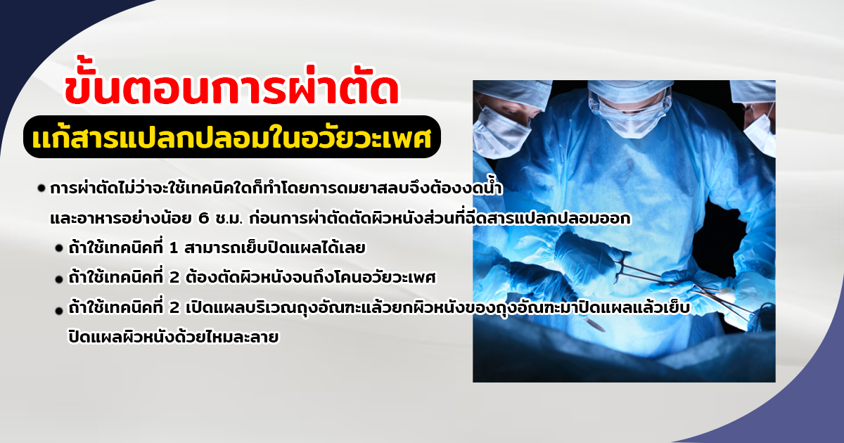เเก้สารเเปลกปลอม