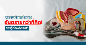 เเก้สารเเปลกปลอม