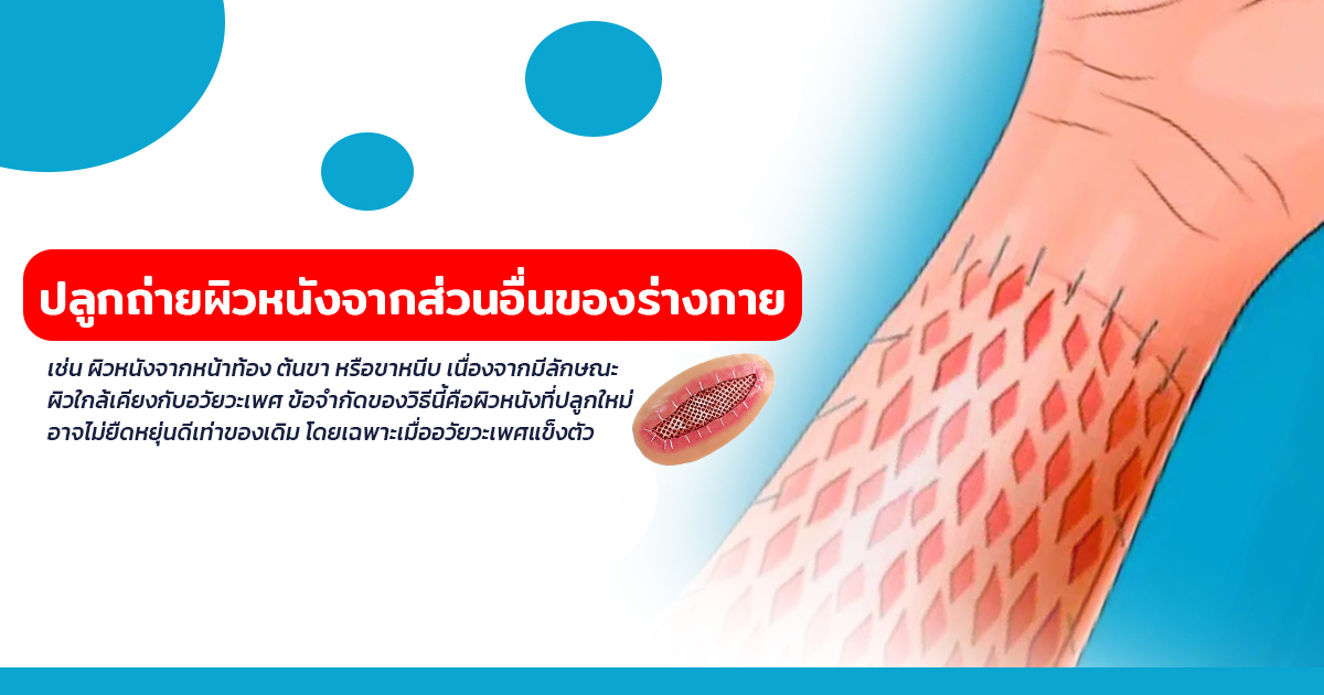 เเก้สารเเปลกปลอม