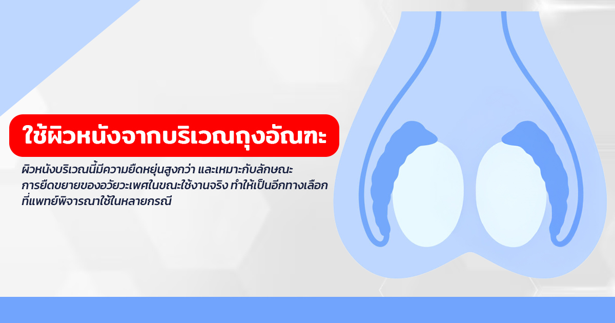 เเก้สารเเปลกปลอม