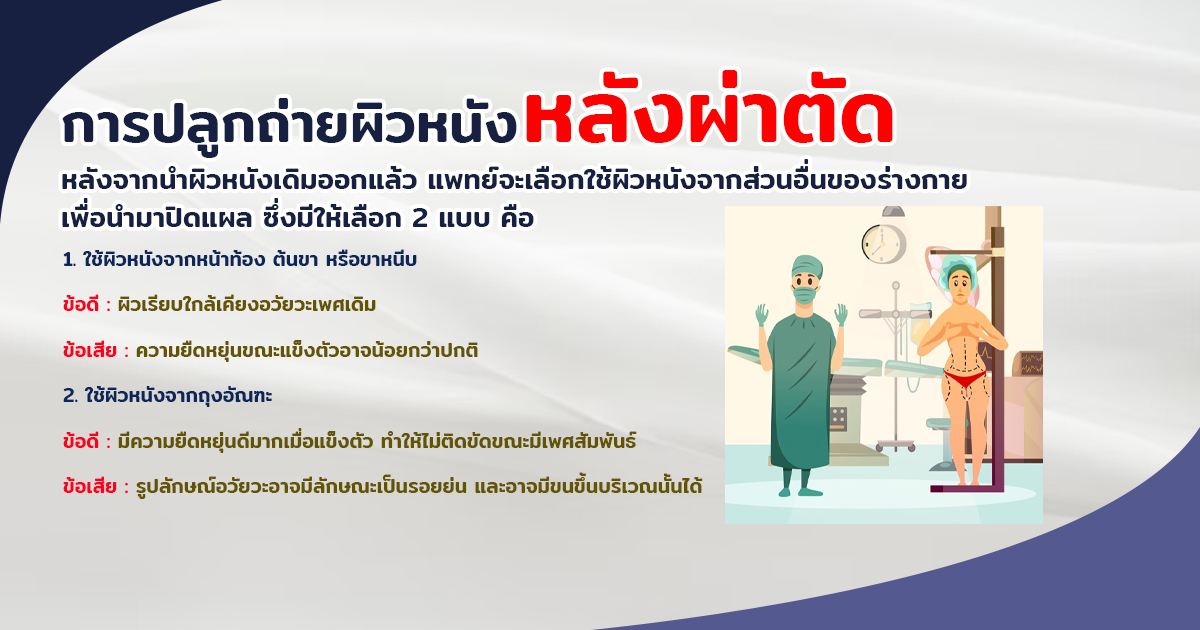 สารเเปลกปลอม