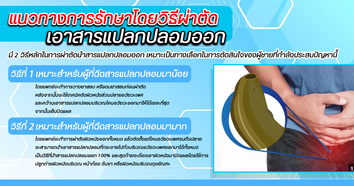 เเก้สารเเปลกปลอม